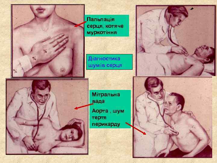 Пальпація серця, котяче муркотіння Діагностика шумів серця Мітральна вада Аорта , шум тертя перикарду