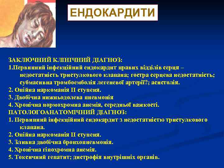 ЕНДОКАРДИТИ ЗАКЛЮЧНИЙ КЛІНІЧНИЙ ДІАГНОЗ: 1. Первинний інфекційний ендокардит правих відділів серця – недостатність тристулкового