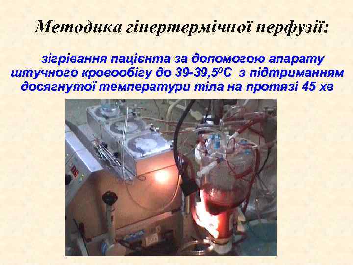 Методика гіпертермічної перфузії: зігрівання пацієнта за допомогою апарату штучного кровообігу до 39 -39, 50