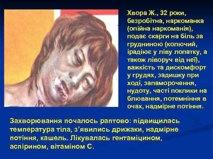 Хвора Ж. , 32 роки, безробітна, наркоманка (опійна наркоманія), подає скарги на біль за
