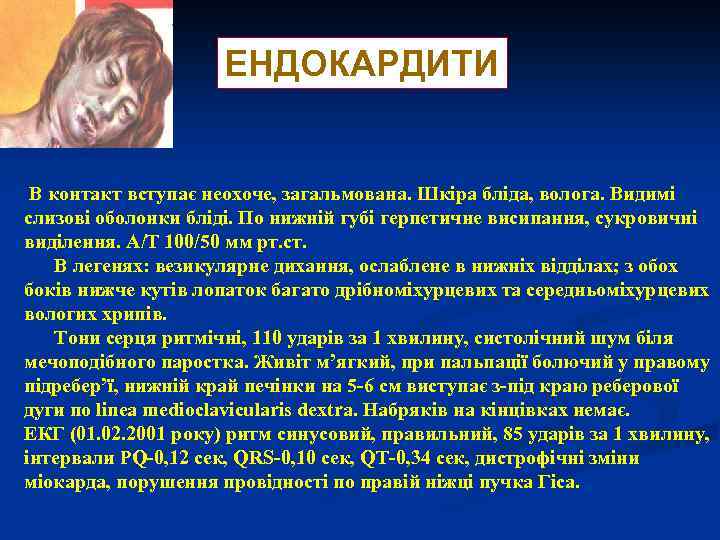 ЕНДОКАРДИТИ В контакт вступає неохоче, загальмована. Шкіра бліда, волога. Видимі слизові оболонки бліді. По