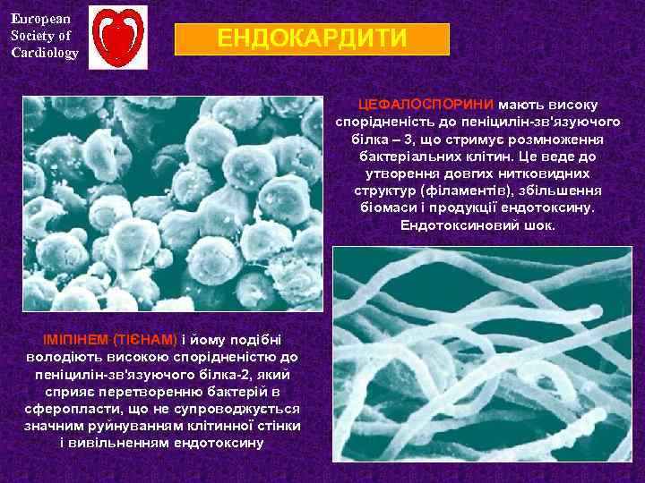 European Society of Cardiology ЕНДОКАРДИТИ ЦЕФАЛОСПОРИНИ мають високу спорідненість до пеніцилін-зв'язуючого білка – 3,