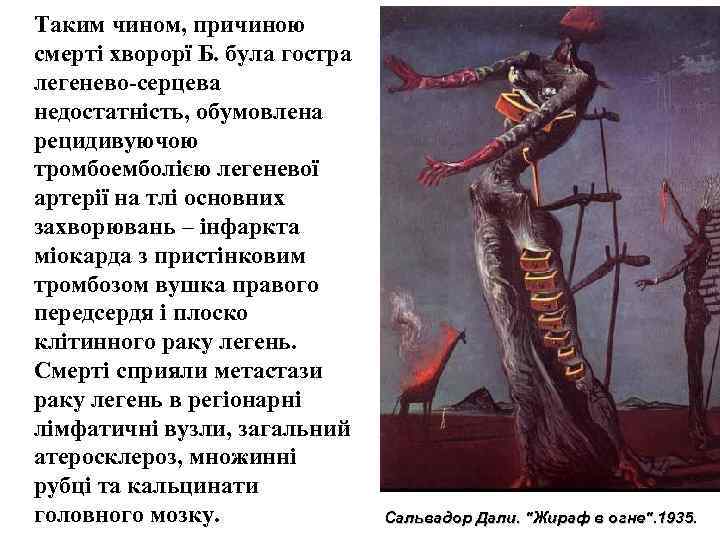 Таким чином, причиною смерті хворорї Б. була гостра легенево серцева недостатність, обумовлена рецидивуючою тромбоемболією