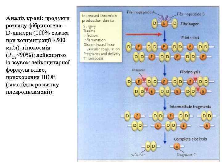 Аналіз крові: продукти розпаду фібриногена – D-димери (100% ознака при концентрації 500 мг/л); гіпоксемія