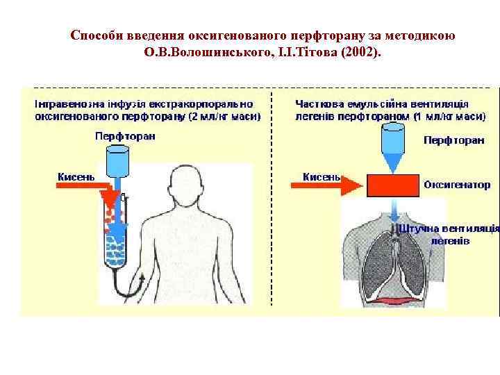 Способи введення оксигенованого перфторану за методикою О. В. Волошинського, І. І. Тітова (2002). 