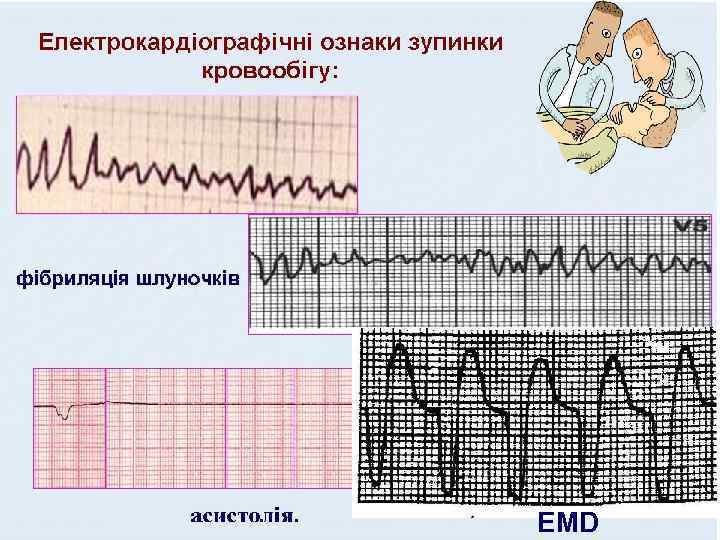 EMD 