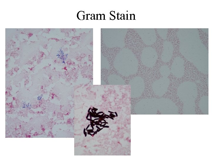 Gram Stain 