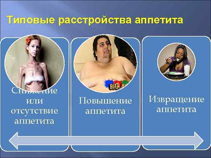 Типовые расстройства аппетита Снижение или отсутствие аппетита Повышение аппетита Извращение аппетита 