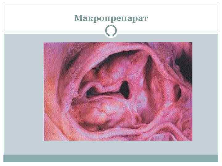 Макропрепарат 