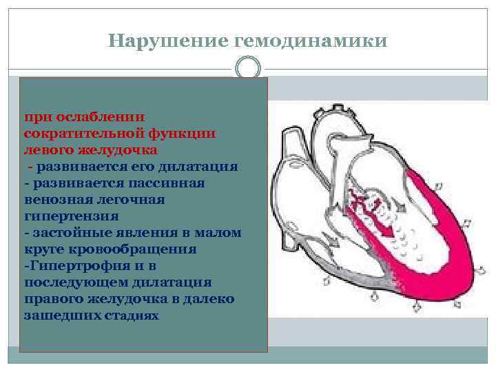 Нарушение гемодинамики при ослаблении сократительной функции левого желудочка - развивается его дилатация - развивается