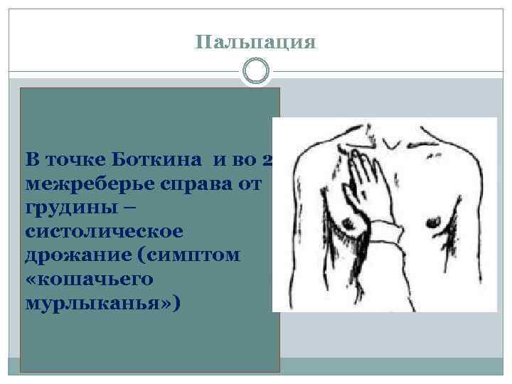 Пальпация - В точке Боткина и во 2 межреберье справа от грудины – систолическое