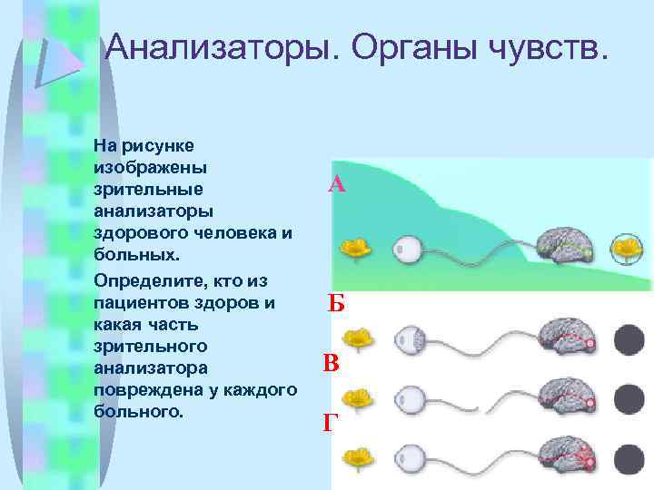 Анализаторы. Органы чувств. На рисунке изображены зрительные анализаторы здорового человека и больных. Определите, кто