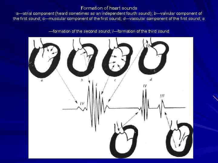 Formation of heart sounds a—atrial component (heard sometimes as an independent fourth sound); b—valvular