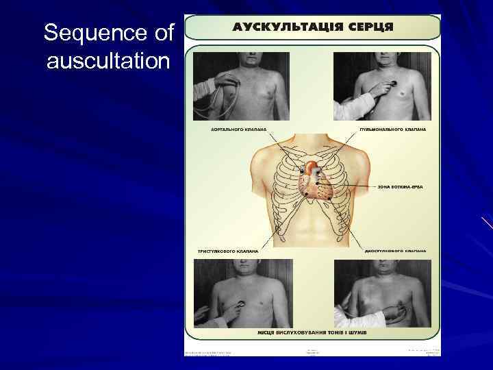 Sequence of auscultation 