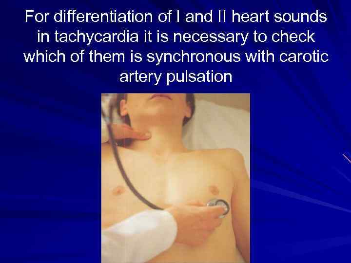 For differentiation of I and II heart sounds in tachycardia it is necessary to