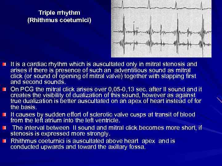 Triple rrhythm (Rhithmus coeturnici) It is a cardiac rhythm which is auscultated only in