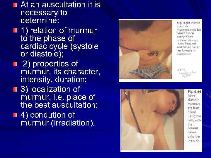 At an auscultation it is necessary to determine: 1) relation of murmur to the