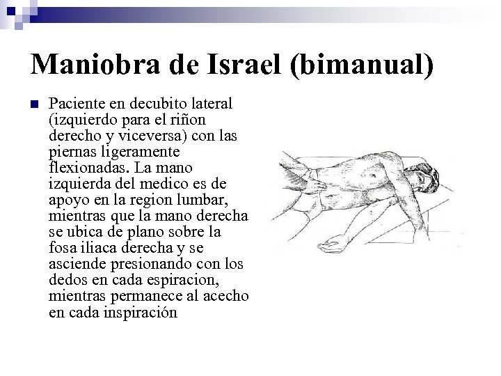 Maniobra de Israel (bimanual) n Paciente en decubito lateral (izquierdo para el riñon derecho