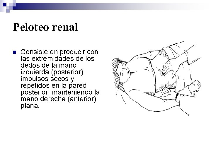 Peloteo renal n Consiste en producir con las extremidades de los dedos de la