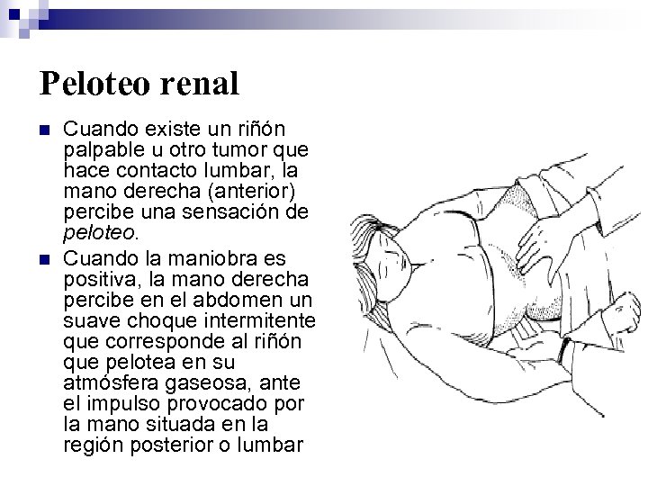 Peloteo renal n n Cuando existe un riñón palpable u otro tumor que hace