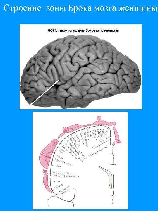Cтроение зоны Брока мозга женщины 