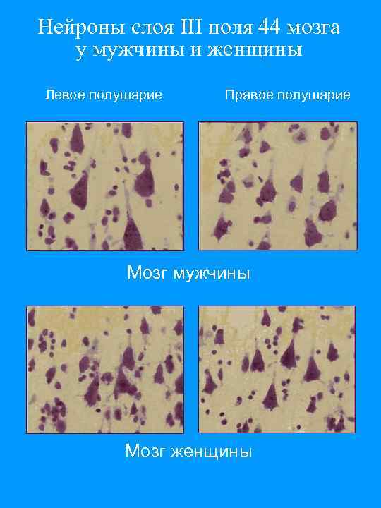 Нейроны слоя III поля 44 мозга у мужчины и женщины Левое полушарие Правое полушарие