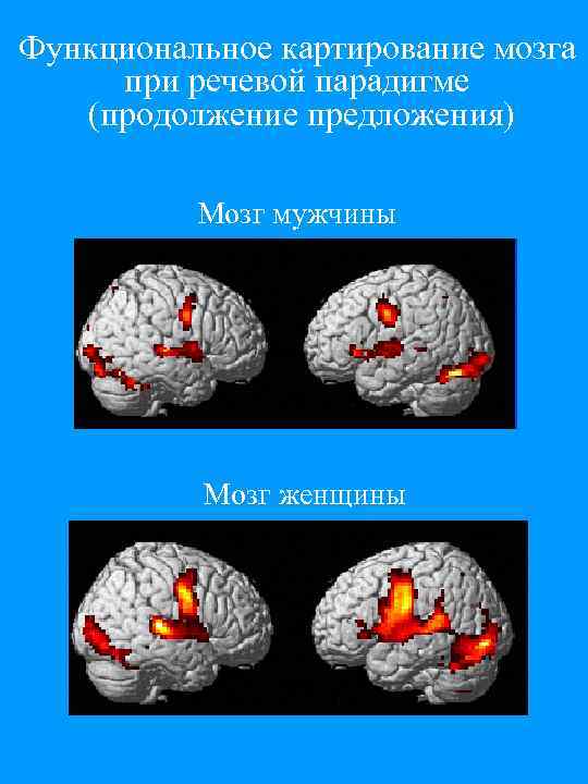 Функциональное картирование мозга при речевой парадигме (продолжение предложения) Мозг мужчины Мозг женщины 