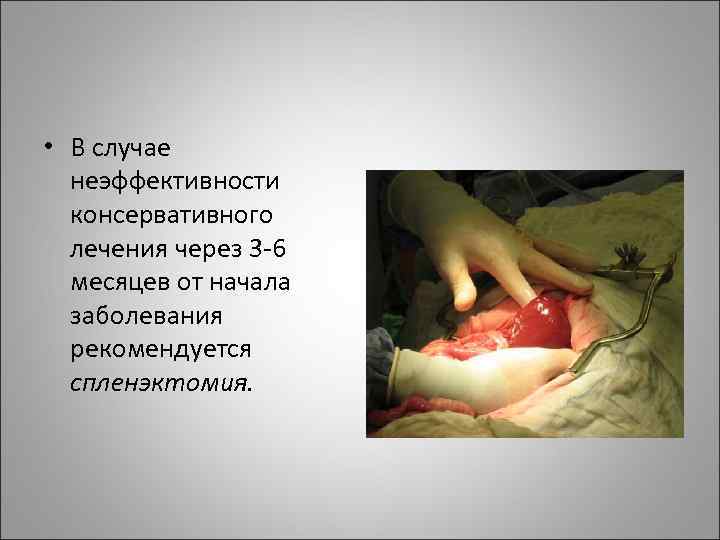  • В случае неэффективности консервативного лечения через 3 -6 месяцев от начала заболевания