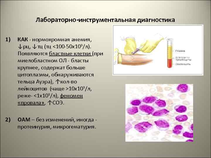 Лейкемоидные реакции презентация