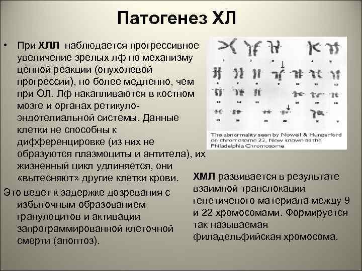 Патогенез хронического лимфолейкоза схема