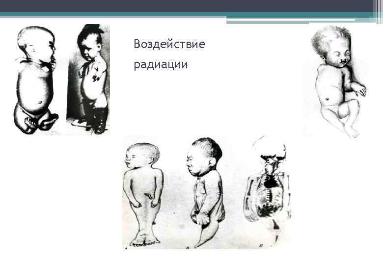 Воздействие радиации 