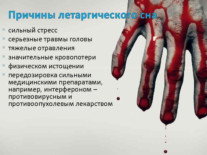 Причины летаргического сна § § § сильный стресс серьезные травмы головы тяжелые отравления значительные