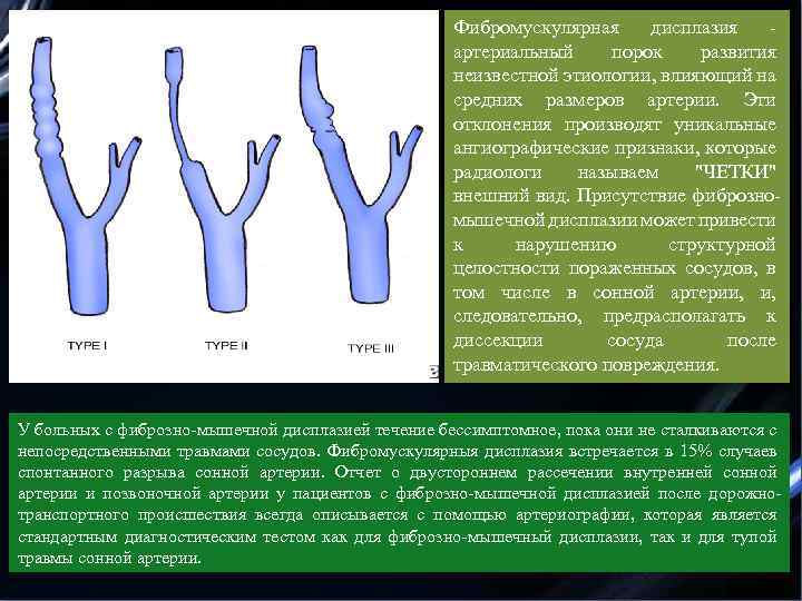 Фибромускулярная дисплазия - артериальный порок развития неизвестной этиологии, влияющий на средних размеров артерии. Эти