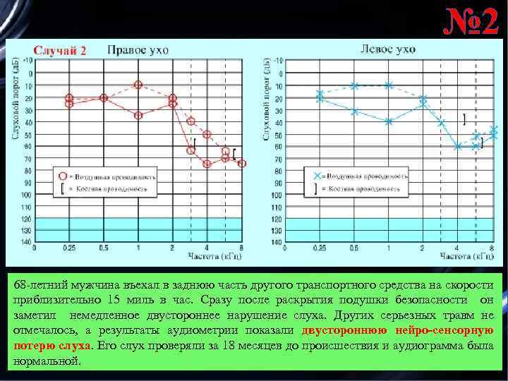 № 2 68 -летний мужчина въехал в заднюю часть другого транспортного средства на скорости