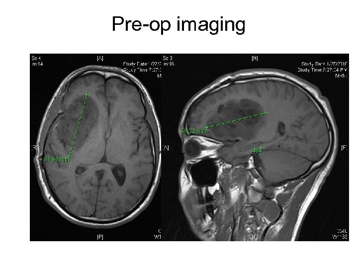 Pre-op imaging 