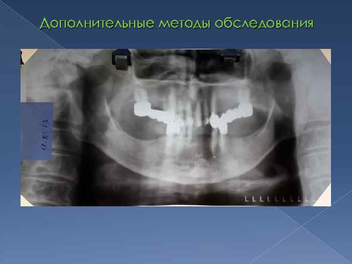 Дополнительные методы обследования 