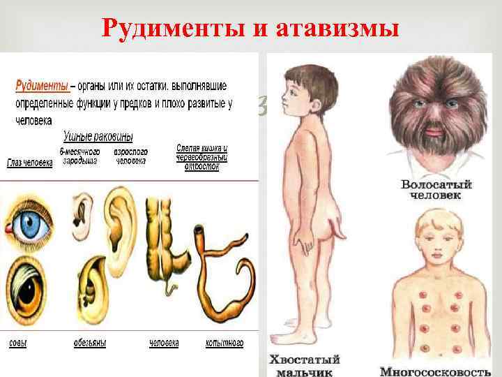 Рудименты и атавизмы 