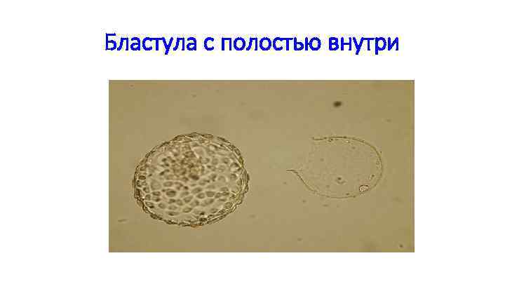 Бластула с полостью внутри 