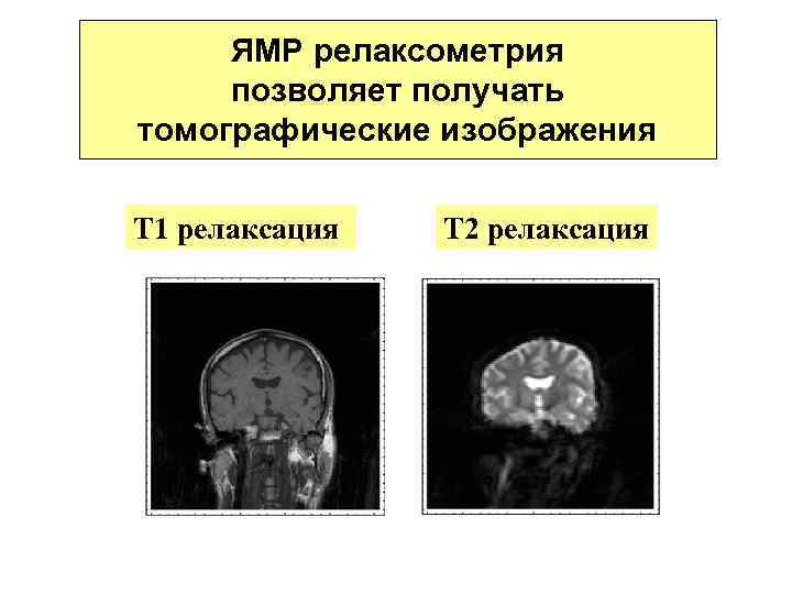 ЯМР релаксометрия позволяет получать томографические изображения Т 1 релаксация Т 2 релаксация 