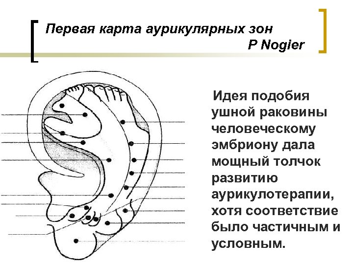 Карта ушной раковины