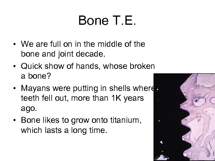Bone T. E. • We are full on in the middle of the bone