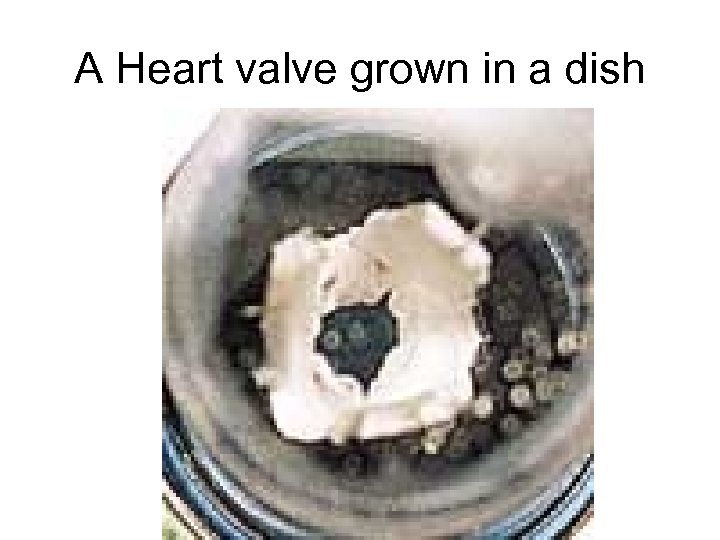 A Heart valve grown in a dish 
