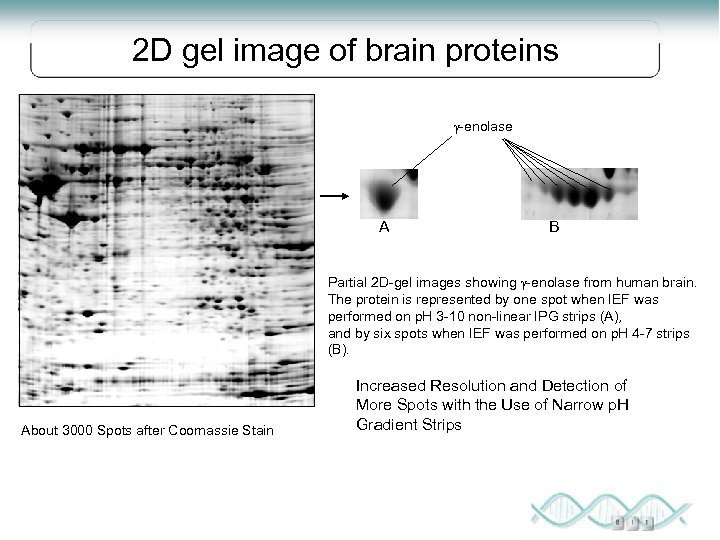 2 D gel image of brain proteins g-enolase A B Partial 2 D-gel images