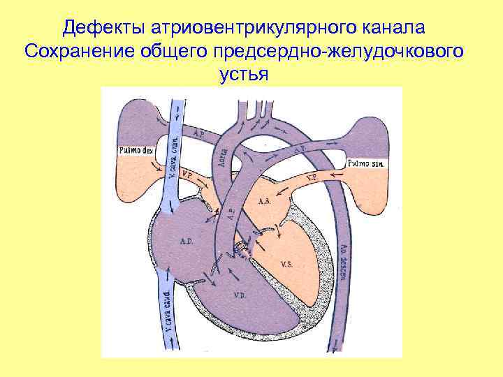 Предсердно желудочковый клапан это