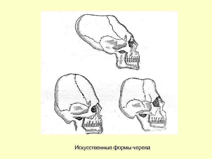 Искусственные формы черепа 