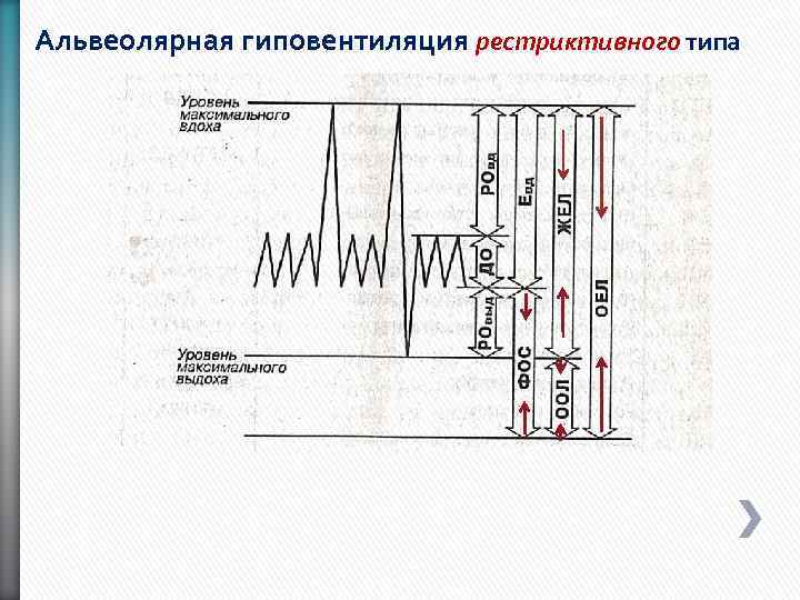 Альвеолярная гиповентиляция рестриктивного типа 
