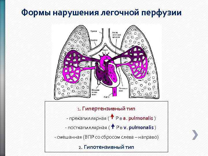Формы нарушения легочной перфузии 1. Гипертензивный тип - прекапиллярная ( Р в а. pulmonalis