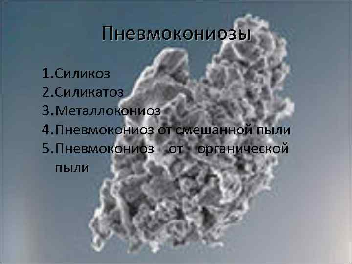 Пневмокониозы 1. Силикоз 2. Силикатоз 3. Металлокониоз 4. Пневмокониоз от смешанной пыли 5. Пневмокониоз
