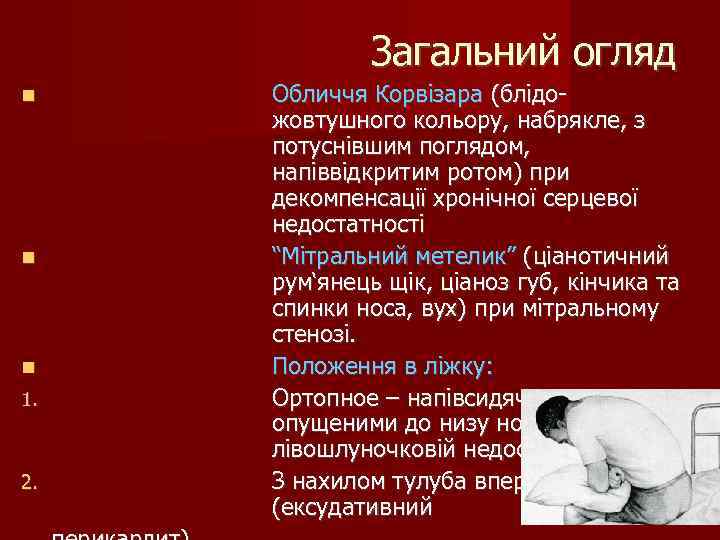 Загальний огляд 1. 2. Обличчя Корвізара (блідожовтушного кольору, набрякле, з потуснівшим поглядом, напіввідкритим ротом)