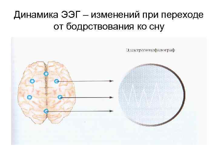 Динамика ЭЭГ – изменений при переходе от бодрствования ко сну 